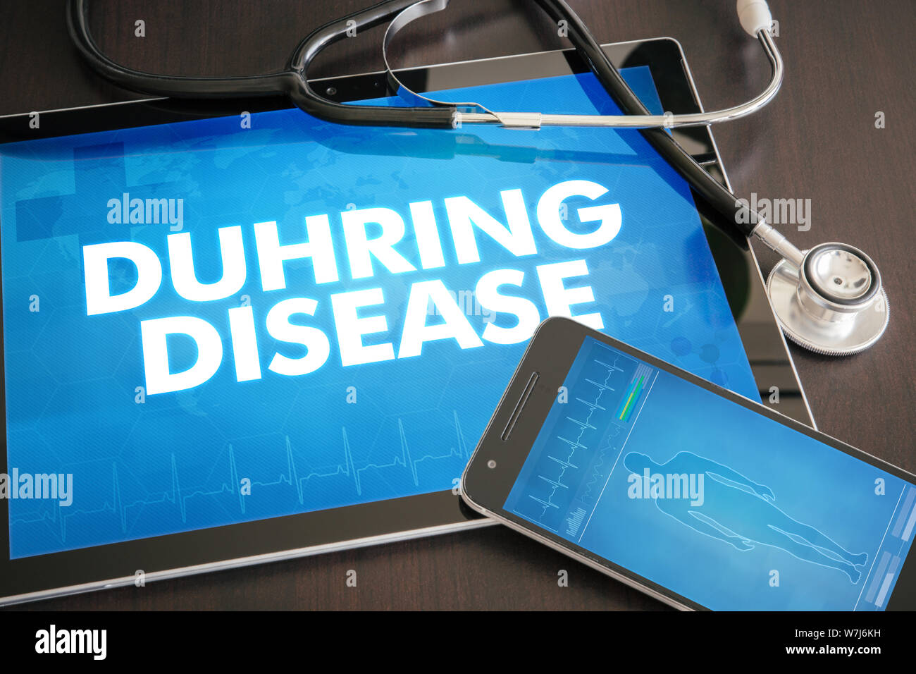 Enfermedad de Duhring (enfermedad cutánea diagnóstico médico oncept) en la pantalla de Tablet PC con el estetoscopio. Foto de stock