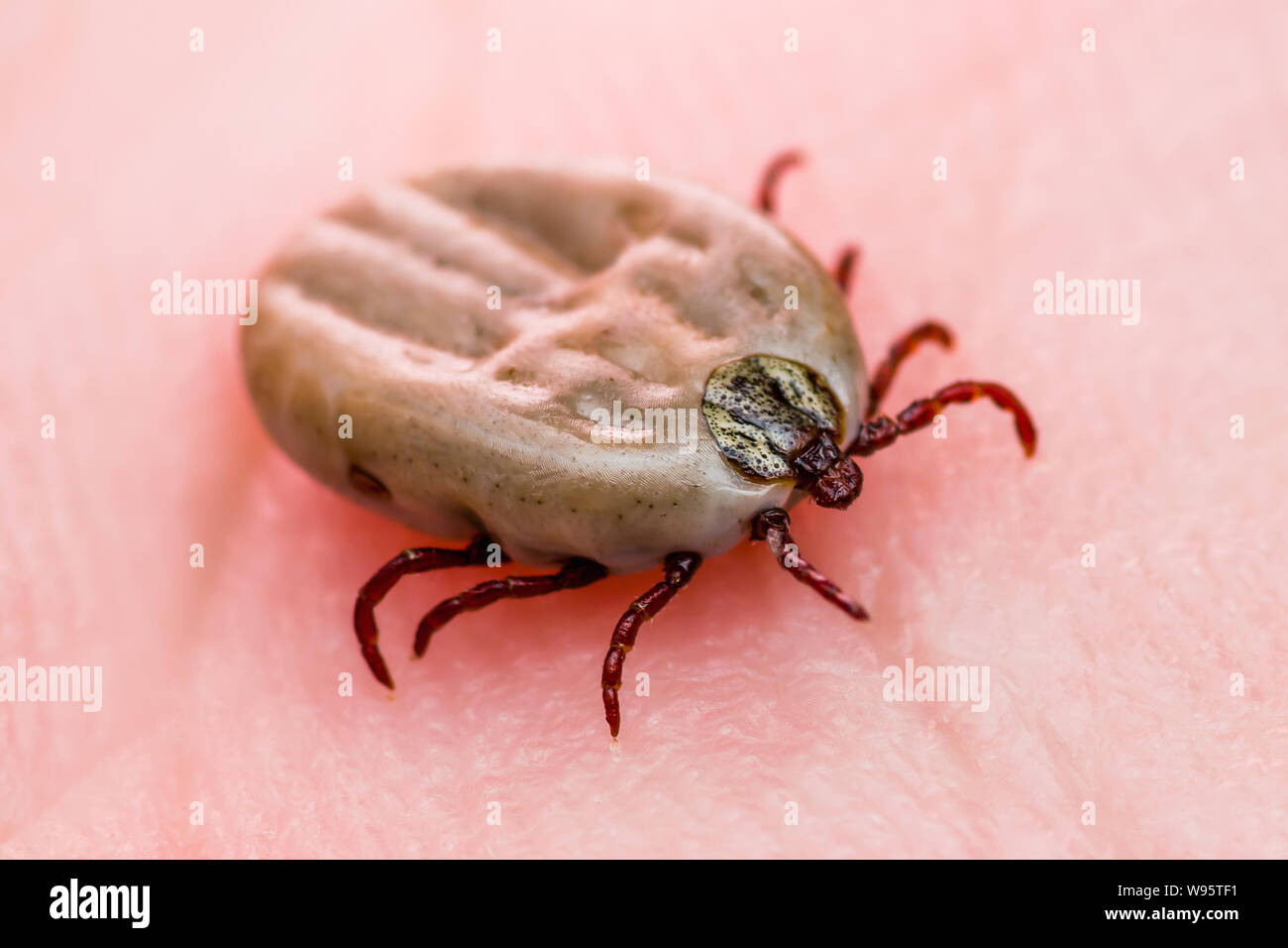 Virus de la encefalitis infecciosa enfermedad Borreliosis de Lyme o garrapata Dermacentor araña en la piel del insecto Macro Foto de stock