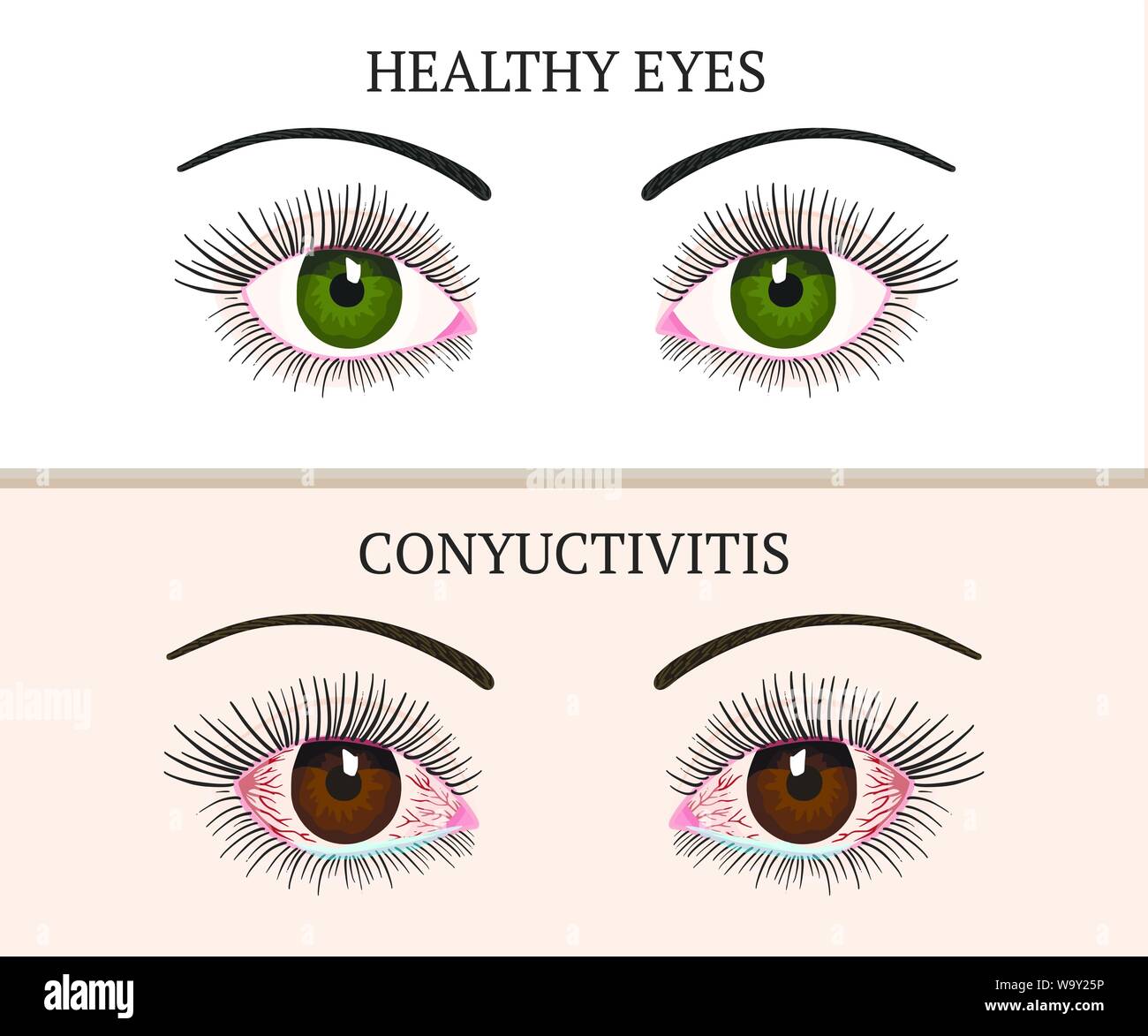 Vectores De Vector Conjuntiva Fotografías E Imágenes De Alta Resolución