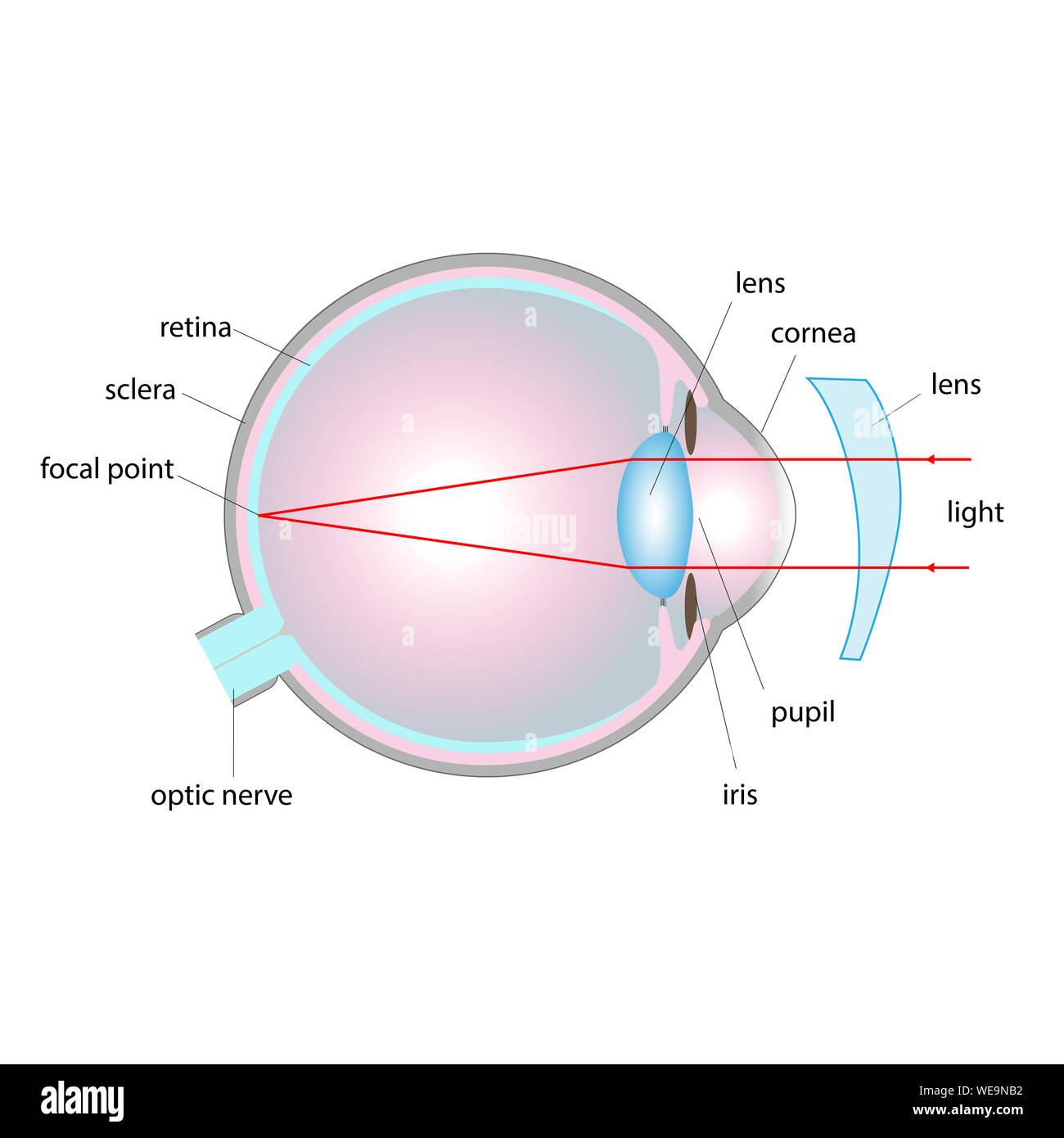 Trastorno de la visión, la ilustración. El astigmatismo, corregido con una lente. Foto de stock