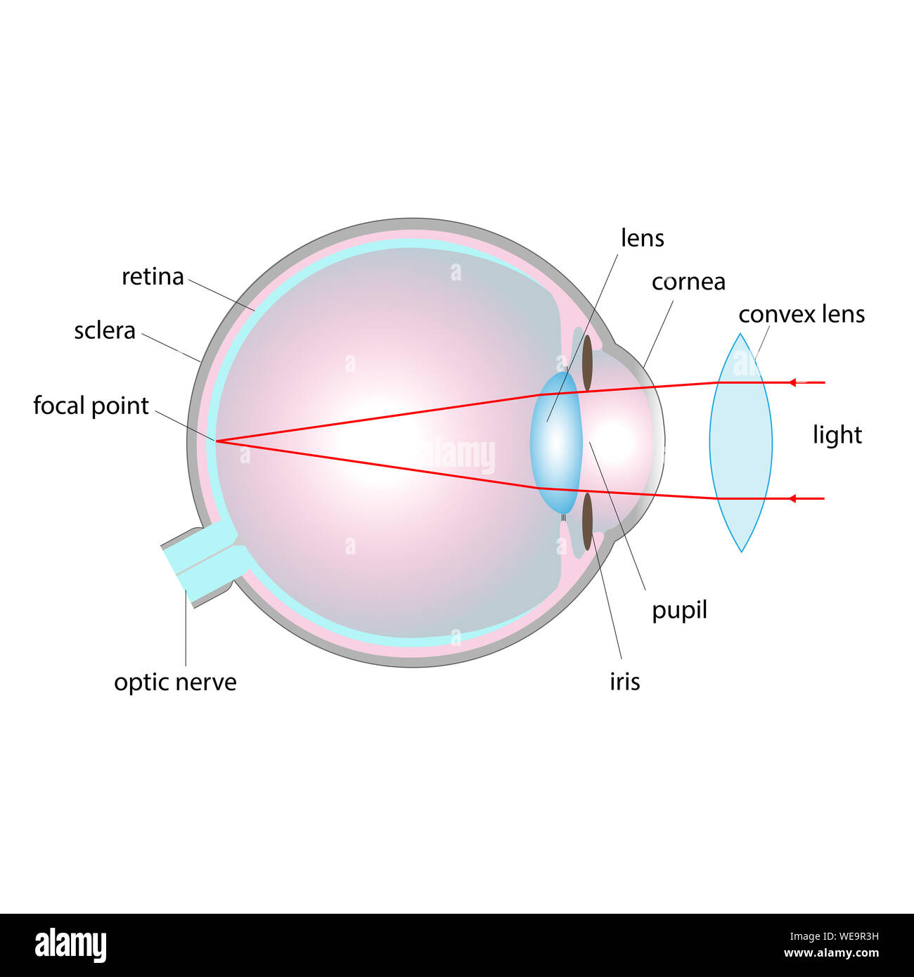 Trastorno de la visión, la ilustración. La hipermetropía (hiperopía) corregida con una lente convexa. Foto de stock