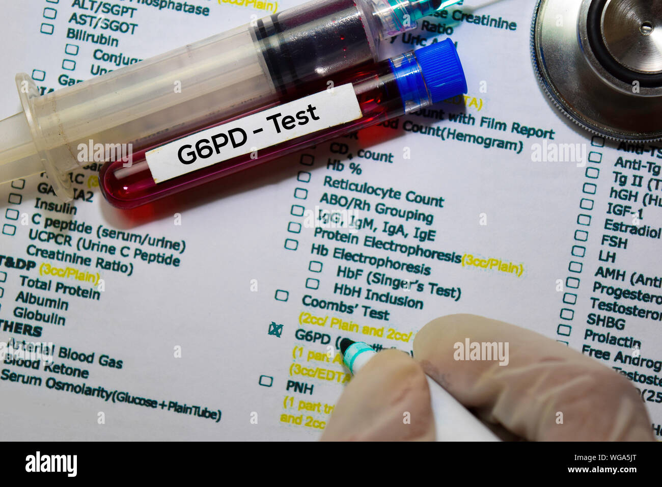 Deficiencia de g6pd fotografías e imágenes de alta resolución Alamy