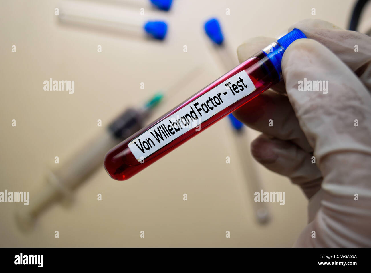 Enfermedad de von willebrand fotografías e imágenes de alta resolución