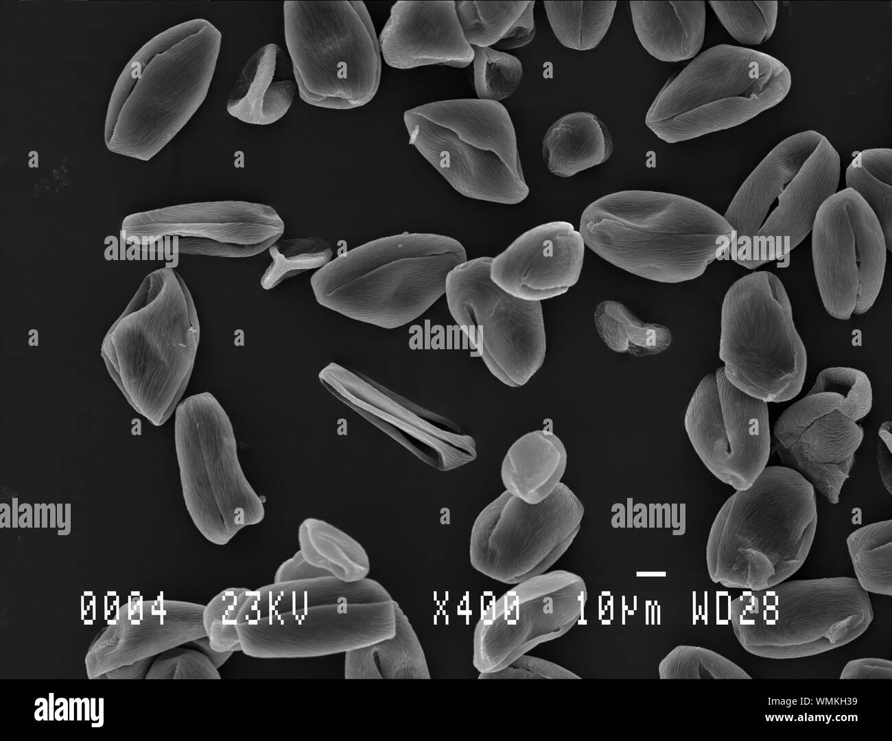 El polen de los árboles de cerezo bajo microscopio electrónico Foto de stock