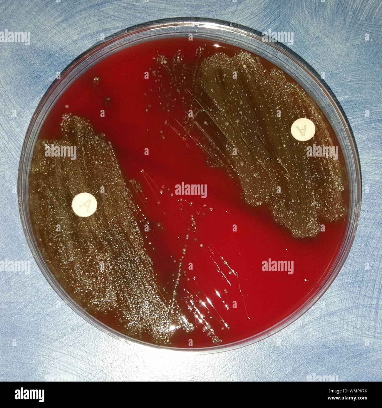 Placa de agar sangre fotografías e imágenes de alta resolución Alamy