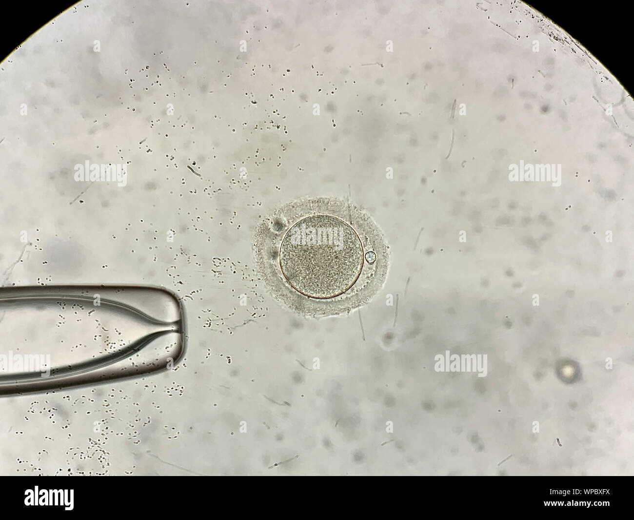 Macro extraordinaria vista a través del microscopio en el proceso de  fecundación in vitro de un óvulo femenino dentro de la FIV dish en el  laboratorio. Horizontal Fotografía de stock - Alamy