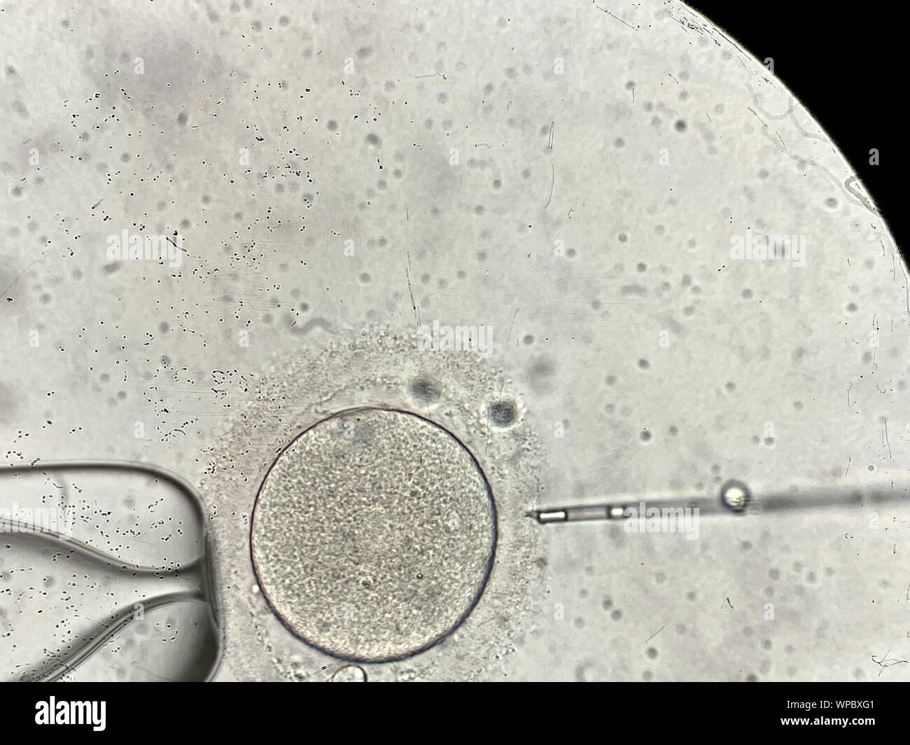 Macro increíble vista a través del microscopio en el proceso de fecundación  in vitro de un óvulo femenino dentro de la FIV dish en el laboratorio.  Horizontal Fotografía de stock - Alamy