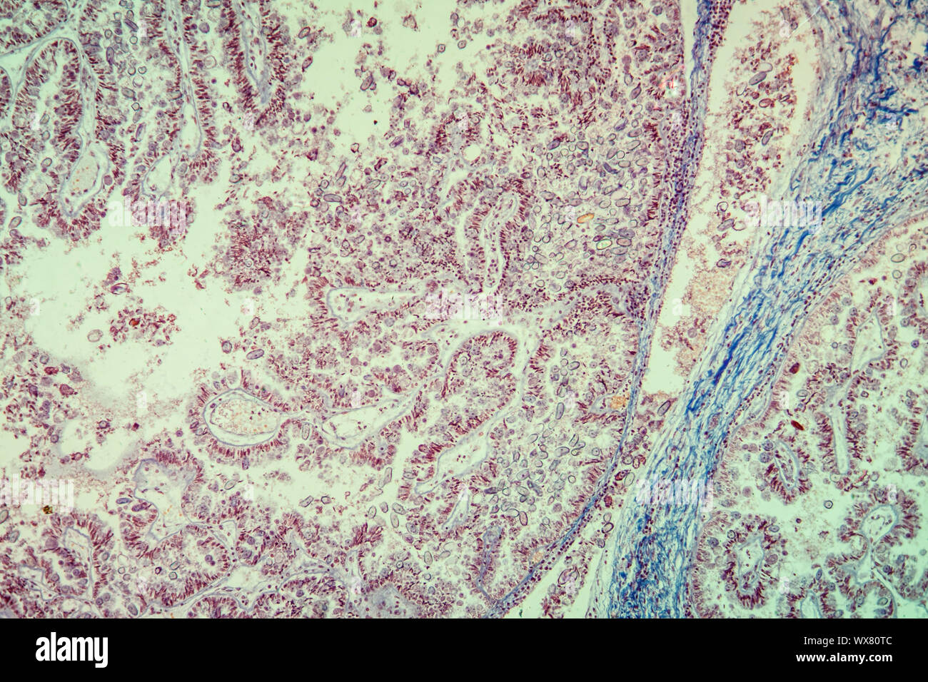 Coccidiosis en tejido hepático de conejo bajo el microscopio 100x  Fotografía de stock - Alamy