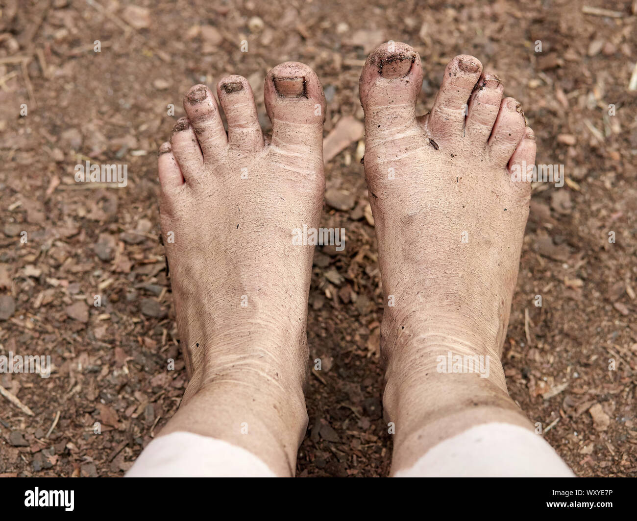 Descalzas con pies sucios fotografías e imágenes de alta resolución Alamy