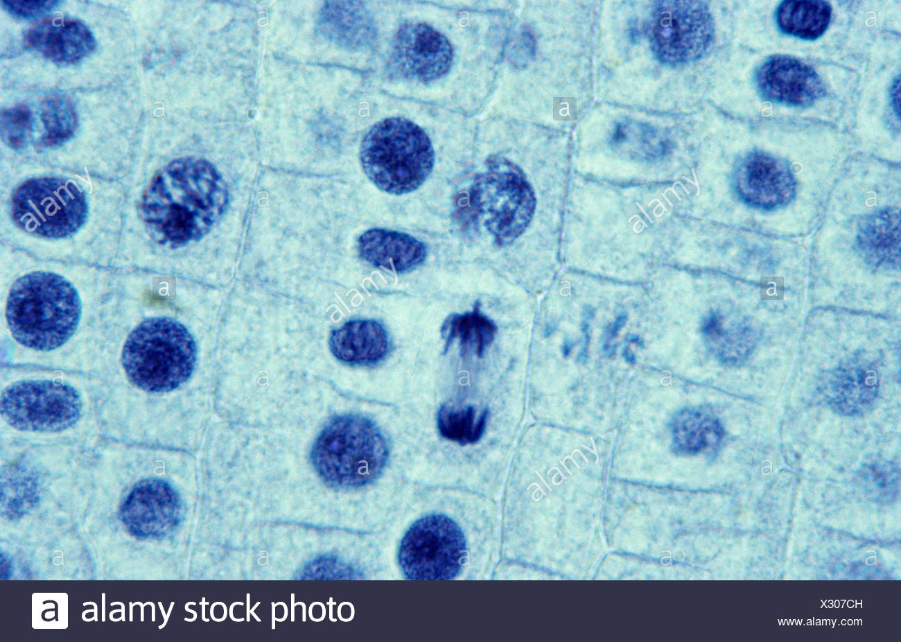 Mitosis De Cebolla Fotos e Imágenes de stock Alamy