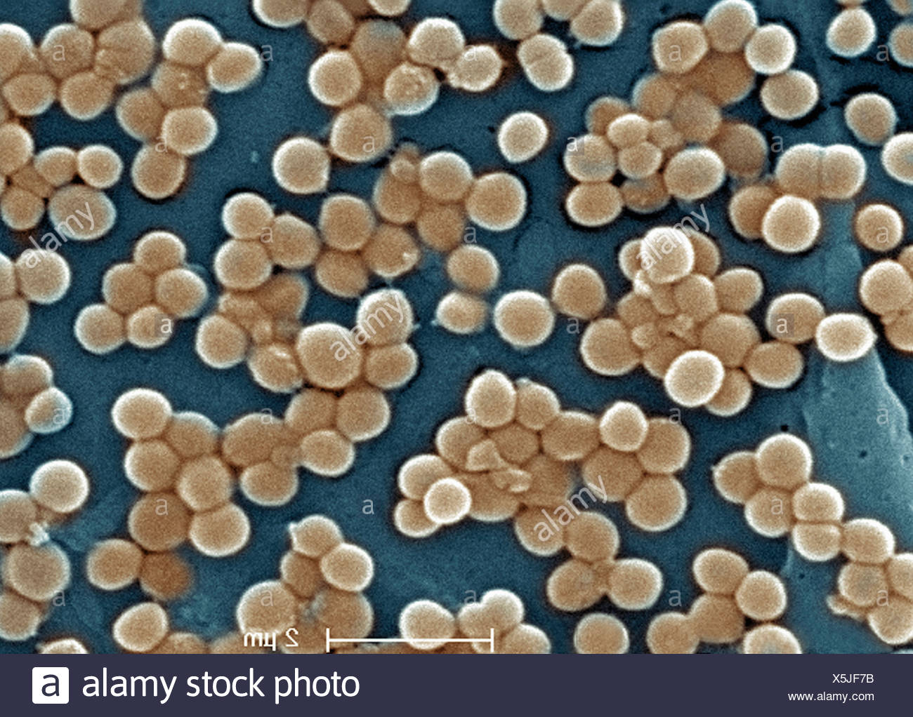 Micrografía electrónica de MRSA Foto de stock