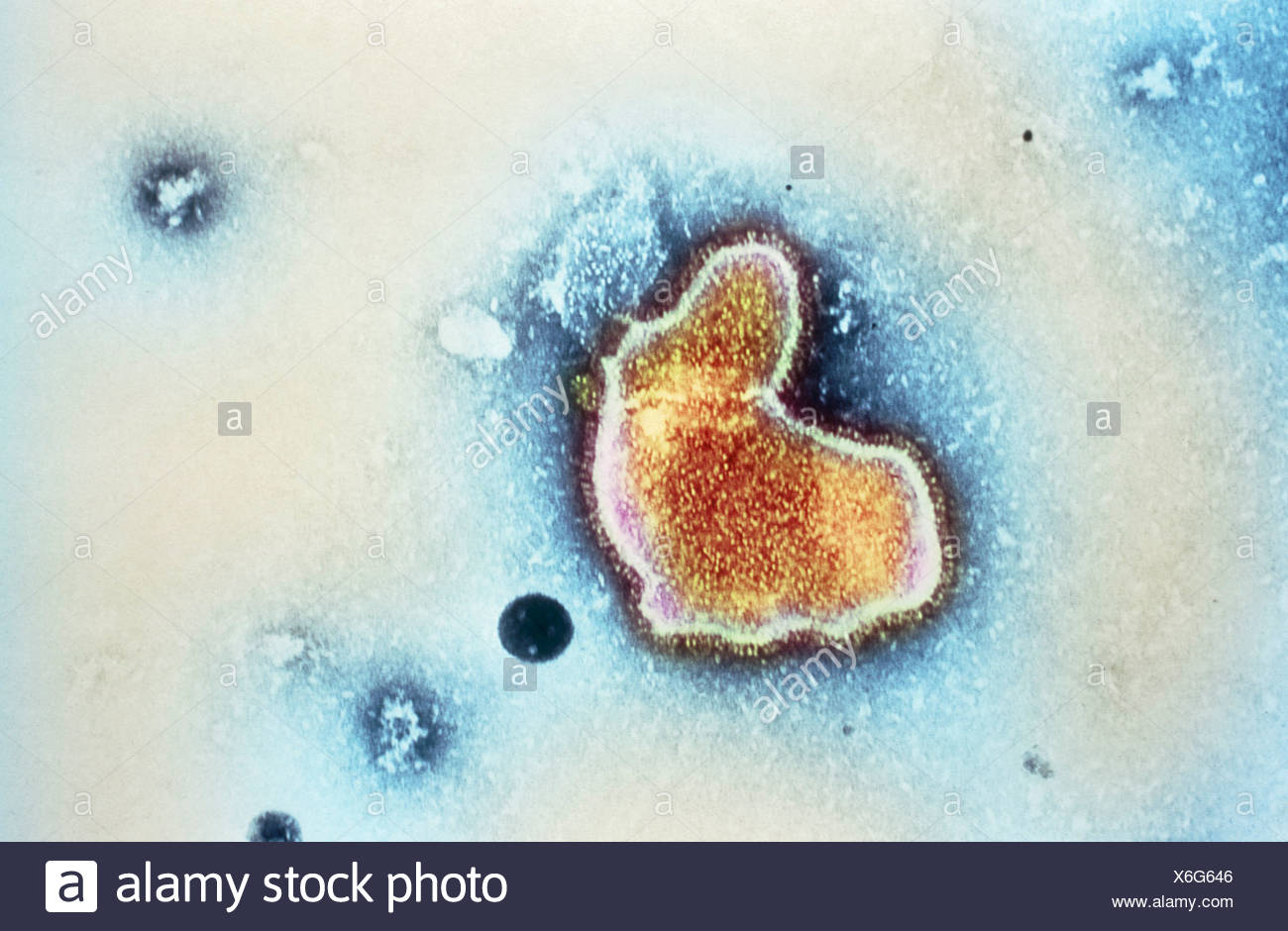 El Virus Sincicial Respiratorio Color Micrografo Electronico De Transmision Tem De Un Virus Respiratorio Sincitial Vrs Fotografia De Stock Alamy