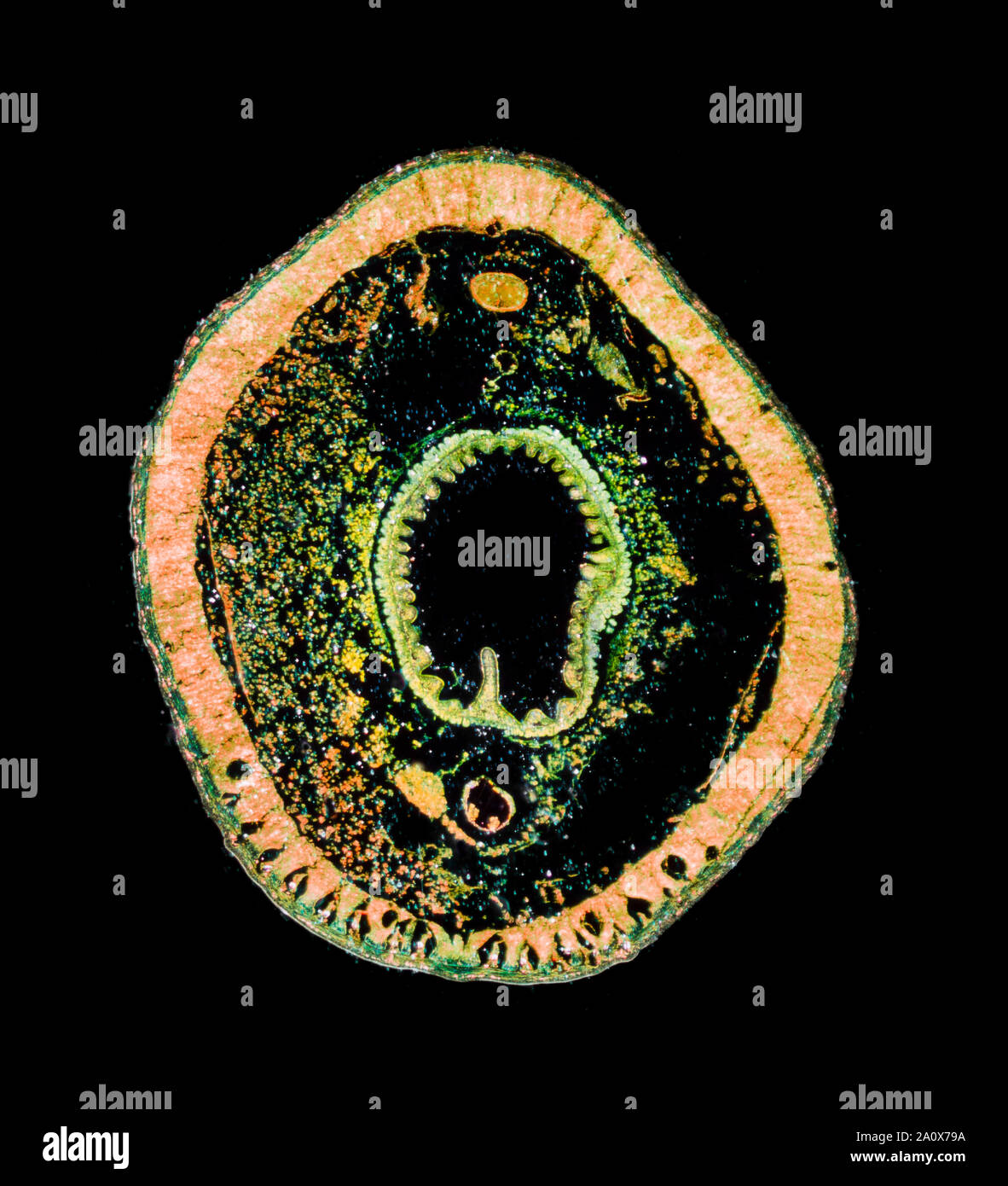 Clonorchis sinensis, les Chinois la douve du foie, est une douve du foie appartenant à la classe Trematoda, darkfield photomicrographie, TS section. Banque D'Images