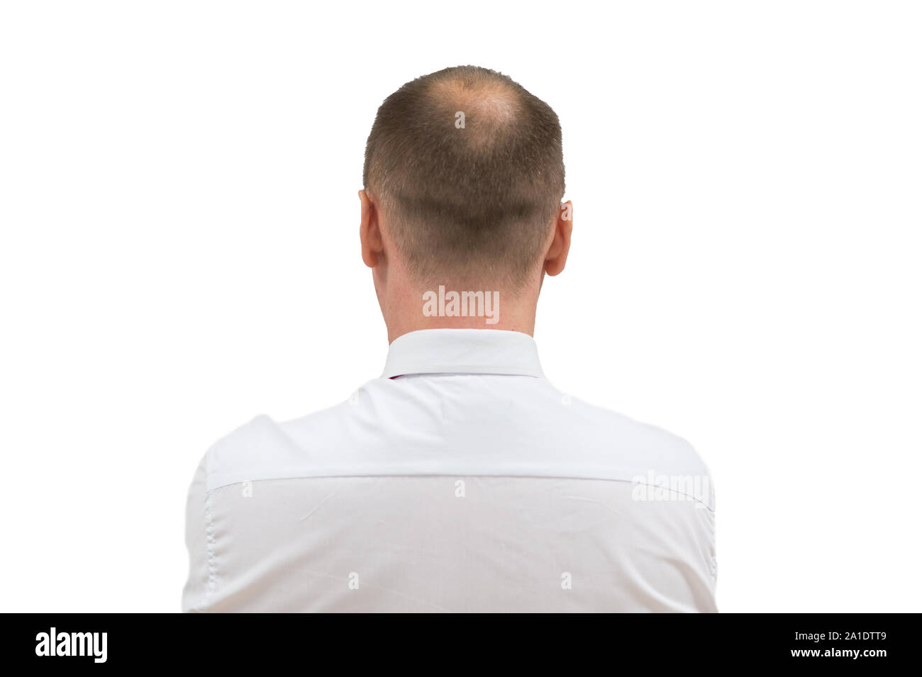 Les droits de l'alopécie ou la perte de cheveux - Hommes adultes bald head. retour de l'homme chauve depuis les épaules isolé sur fond blanc. Banque D'Images
