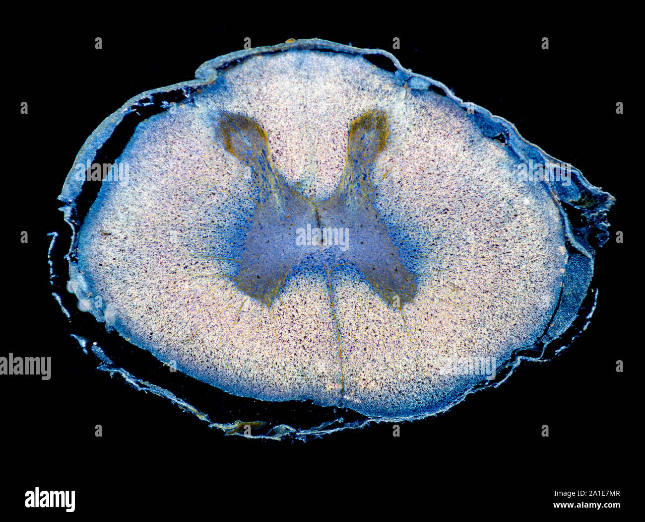 La moelle épinière du fœtus humain, TS, section vitrail darkfield photomicrographie Banque D'Images