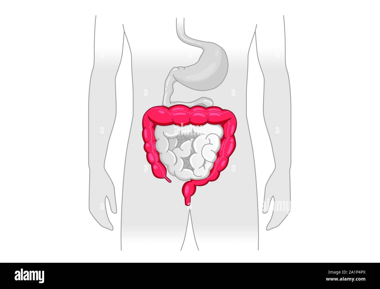 Illustration à propos de symptôme anormal des droits de gros intestin. Illustration de Vecteur