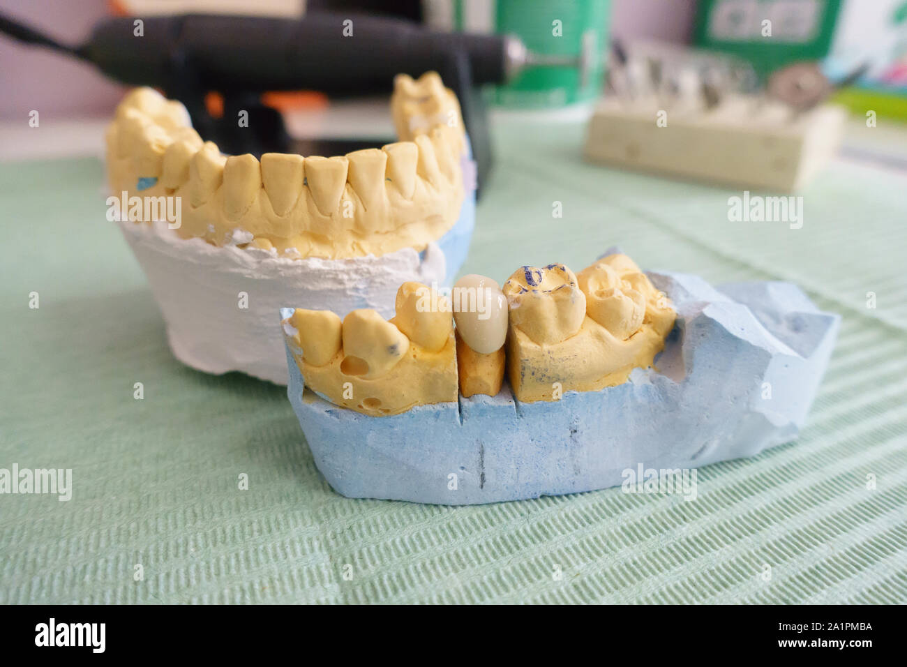 Dentiste examine les couronnes dentaires artificielles sur un modèle dans son bureau Banque D'Images