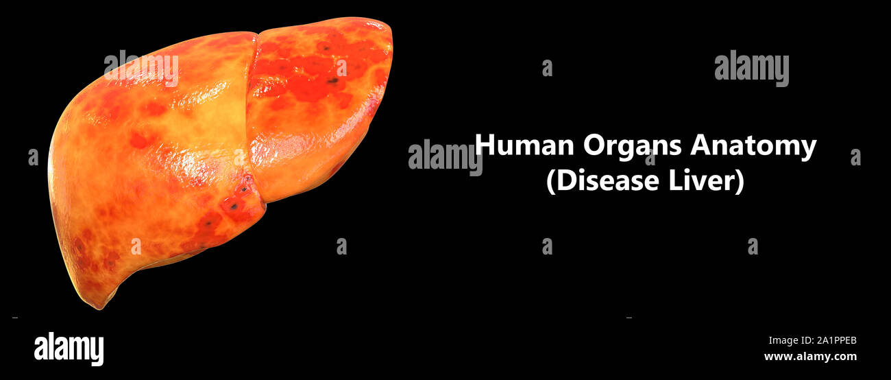 L'Organe digestif interne Anatomie du foie Banque D'Images