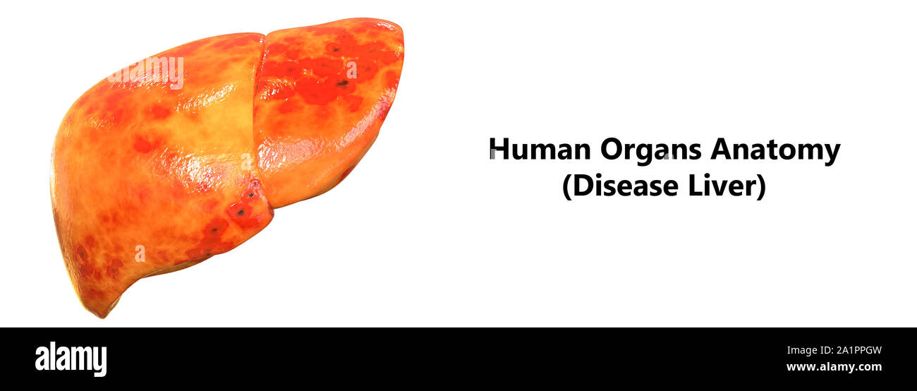 L'Organe digestif interne Anatomie du foie Banque D'Images