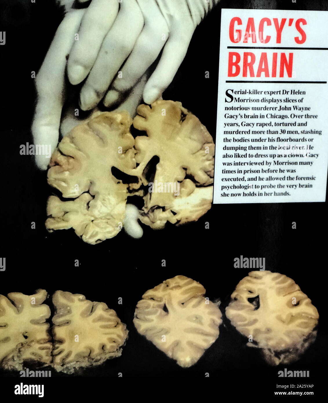 Featured - John Wayne Gacy Brain