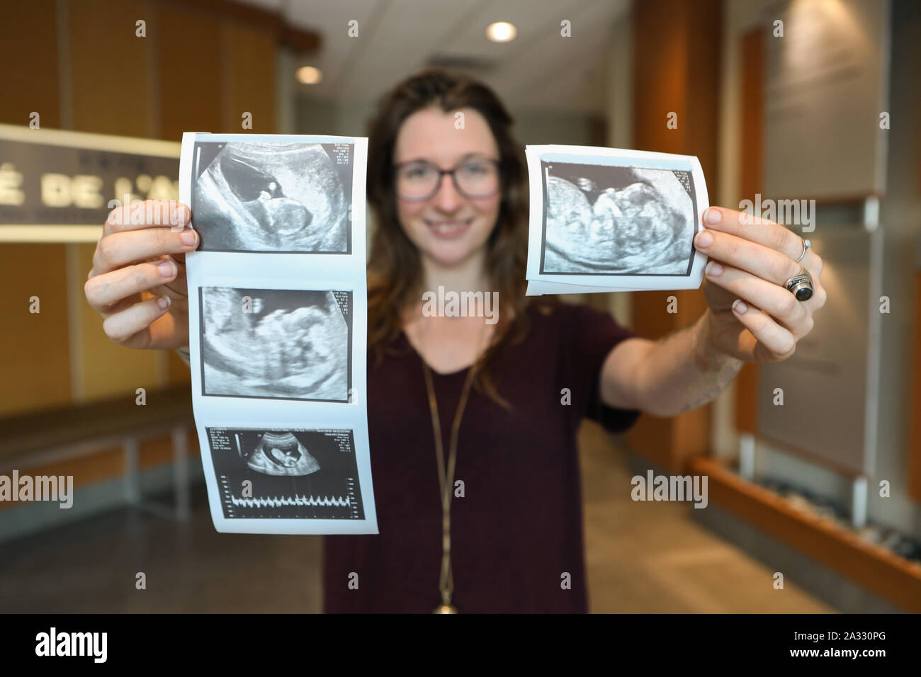 6 Month Fetus Banque D Image Et Photos Alamy