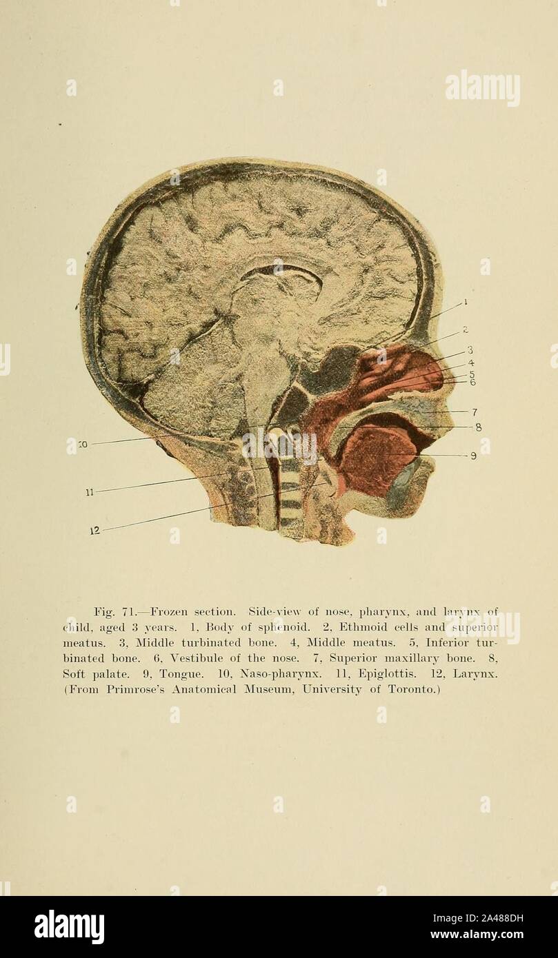 Fig. 71. Frozen section. Vue latérale du nez, du pharynx et du larynx de l'enfant, âgé de 3 ans. Banque D'Images