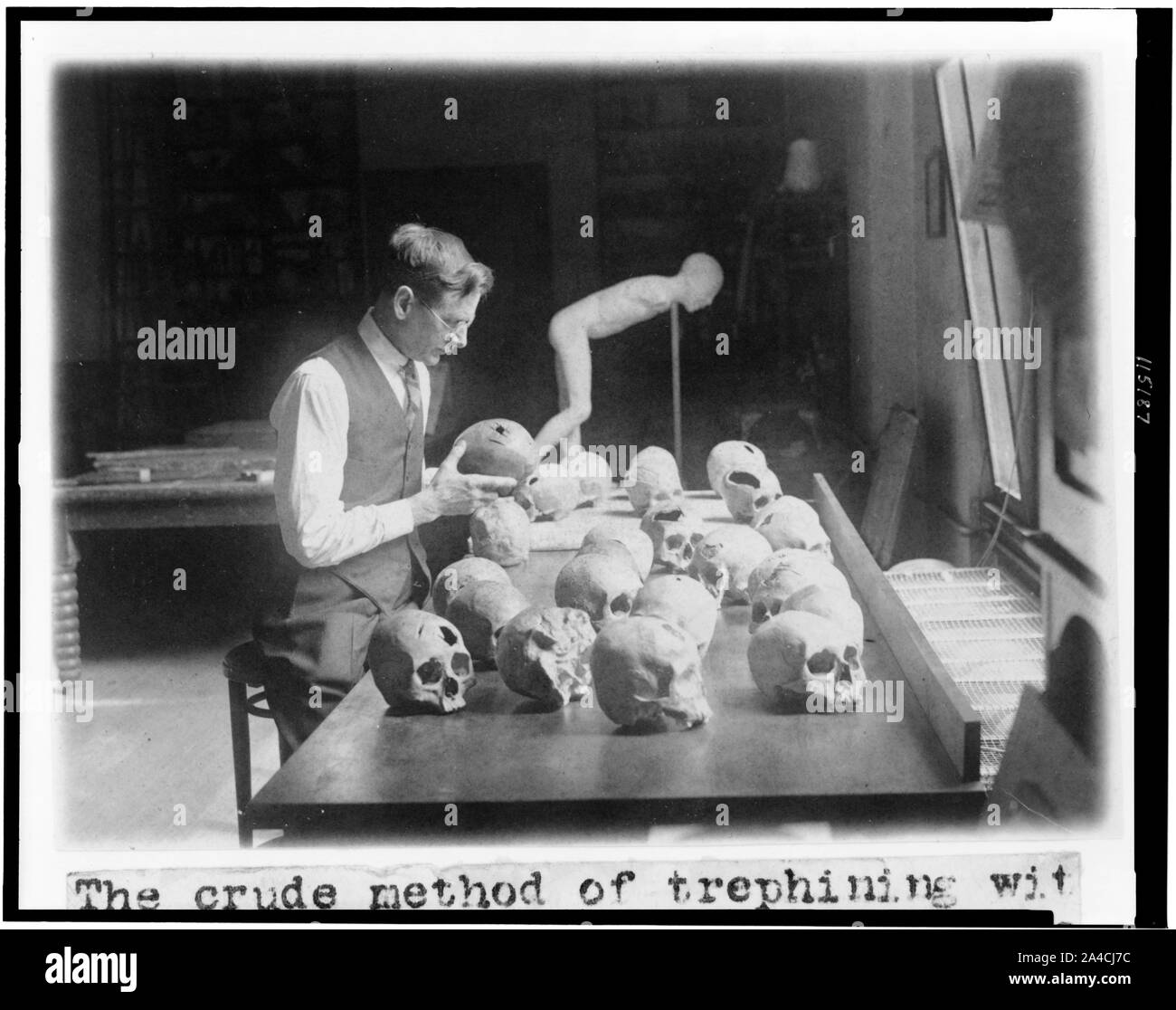 La méthode de pétrole brut [sic] trephining avec la pointe aiguisée d'une pierre pratiquée par les peuples vivant au Pérou quelque 500 ou 600 ans, est révélé par les crânes au Musée National Banque D'Images