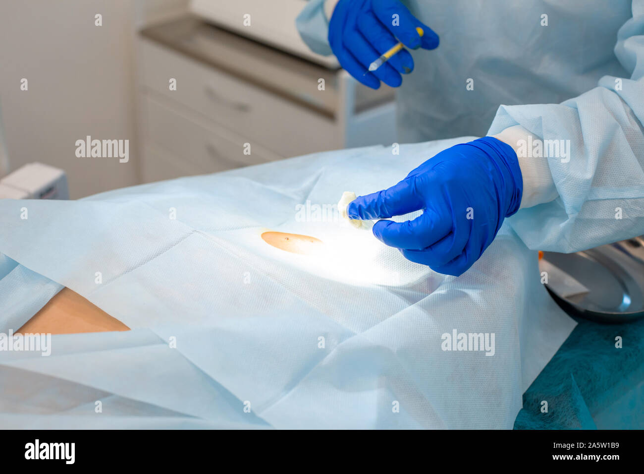 Une injection d'un anti-douleur à l'emplacement d'une chirurgie de déplacement de taupe. Banque D'Images