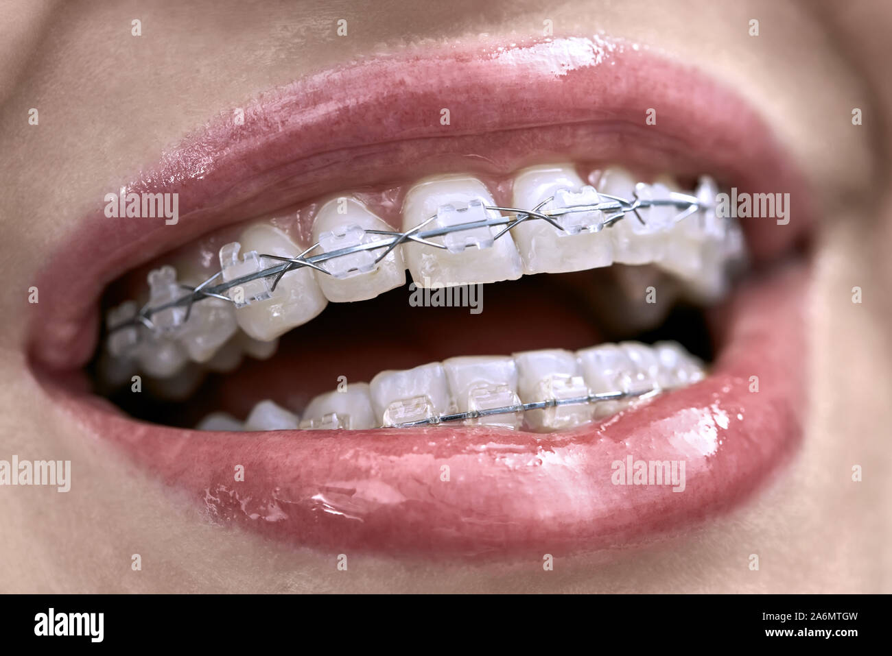 Superbe fille est montrant ses dents avec accolade dans une clinique dentaire. Horizontal macro photo. Banque D'Images