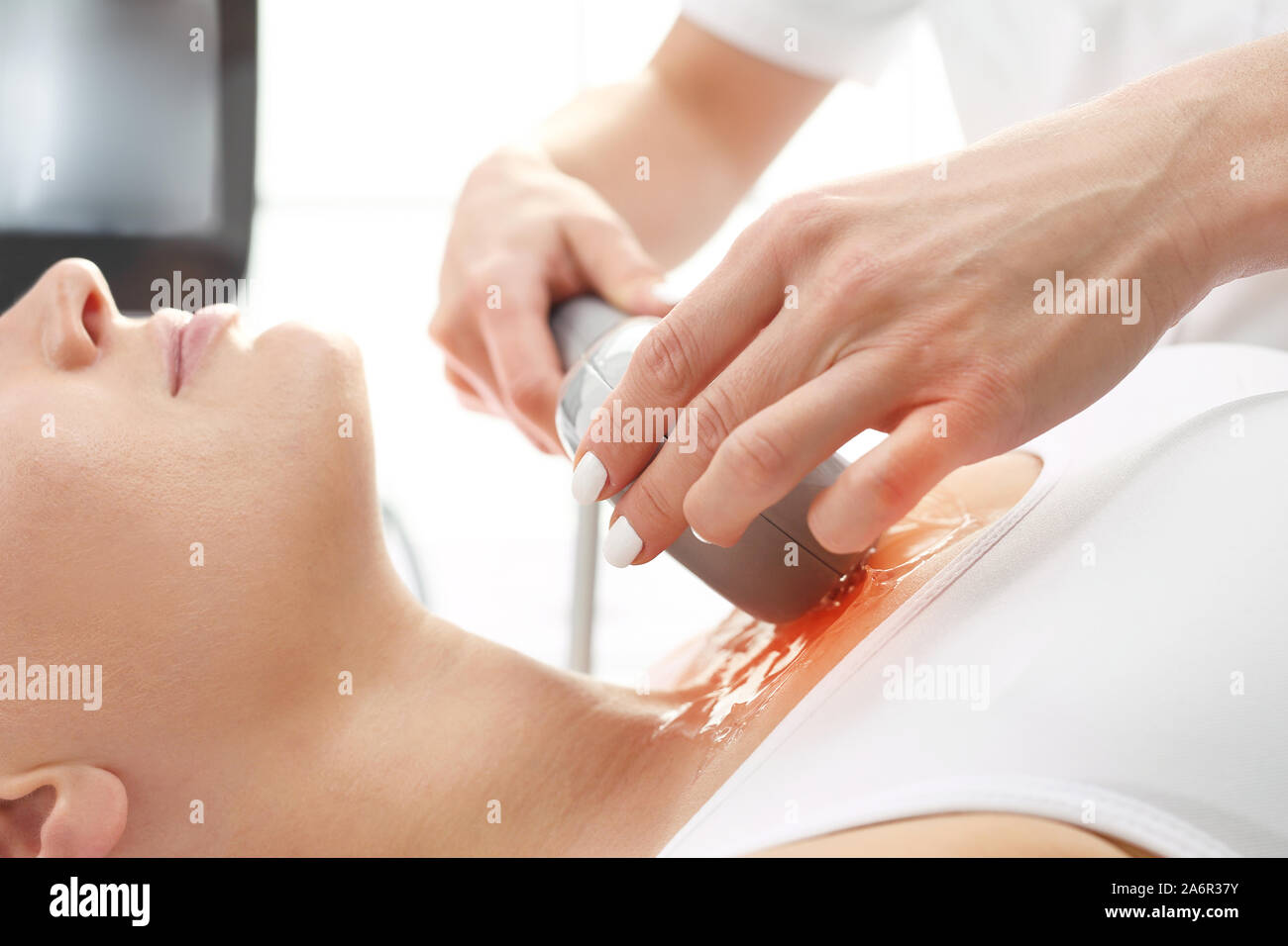 Thermolifting de la peau. Un soin cosmétique rajeunissant traitement en clinique de médecine esthétique. Banque D'Images