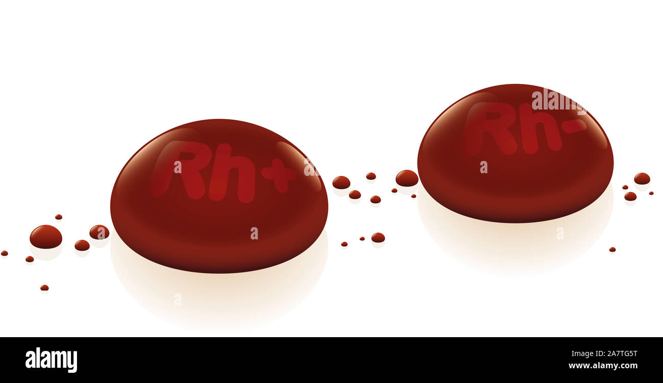 Le facteur rhésus, deux gouttes de sang marqué, Rh + et Rh- - illustration sur fond blanc. Banque D'Images