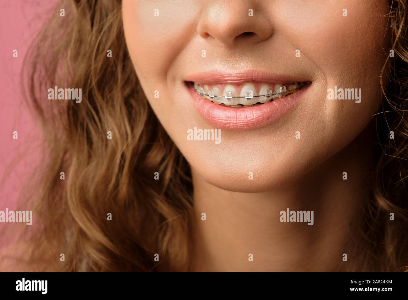 Photo de gros plan joli sourire de femme de race blanche sourire avec les cheveux bouclés portant appareil dentaire isolé sur fond rose. Banque D'Images