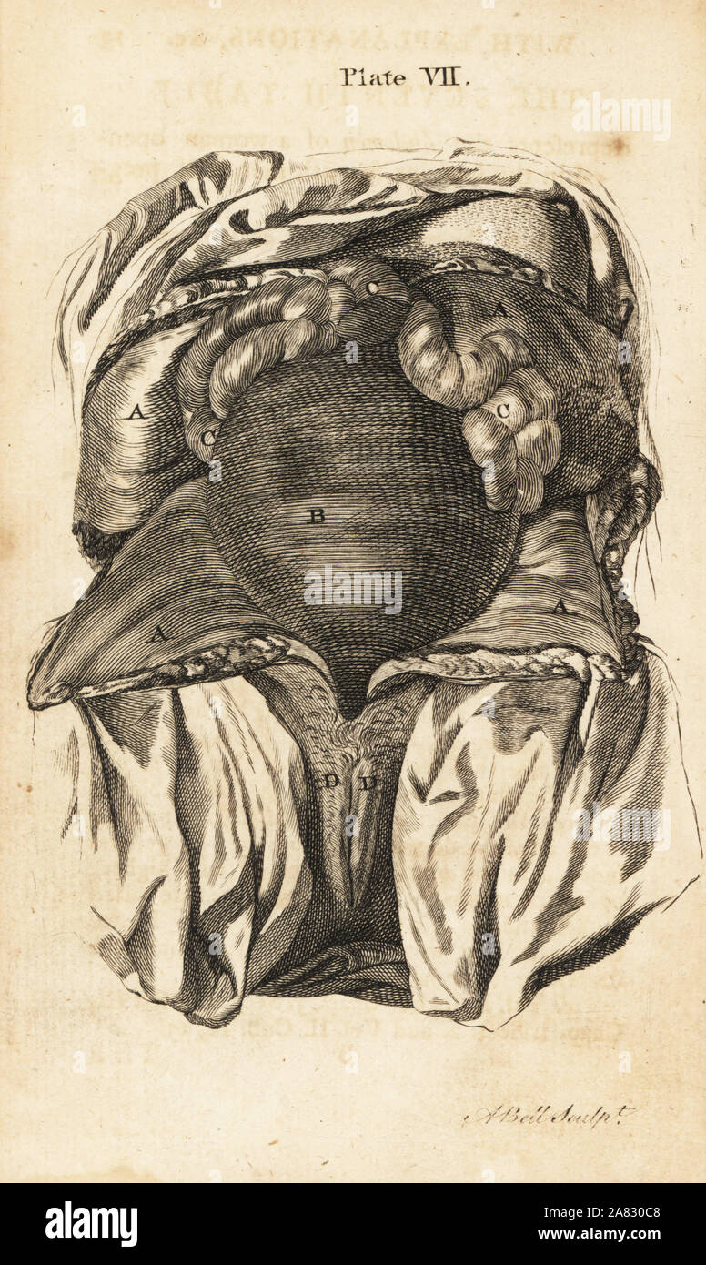 L'abdomen d'une femme dans le sixième ou septième mois de grossesse, montrant l'utérus, des intestins, de petites lèvres pudendi. La gravure sur cuivre par Andrew Bell après une illustration par Jan van Rymsdyk de William Smellie est un ensemble de tables anatomiques, Charles Elliot, Édimbourg, 1780. Banque D'Images