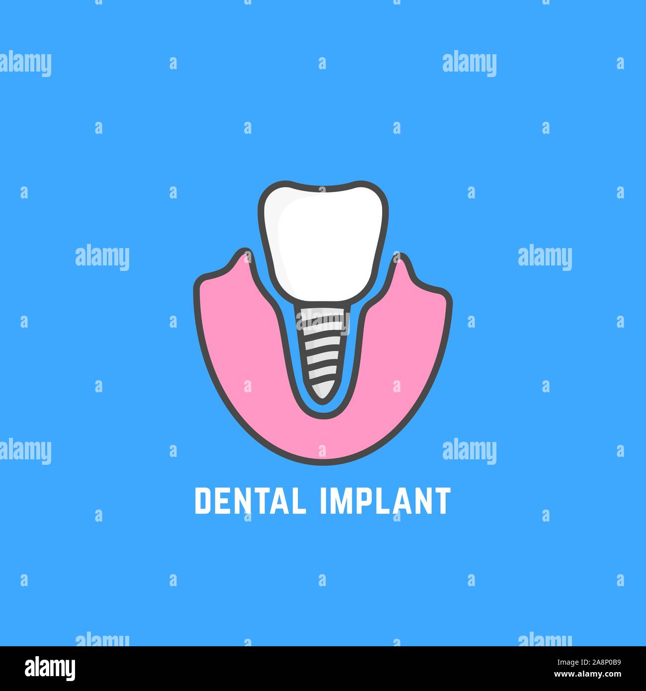 Icône simple d'implant dentaire blanc Illustration de Vecteur