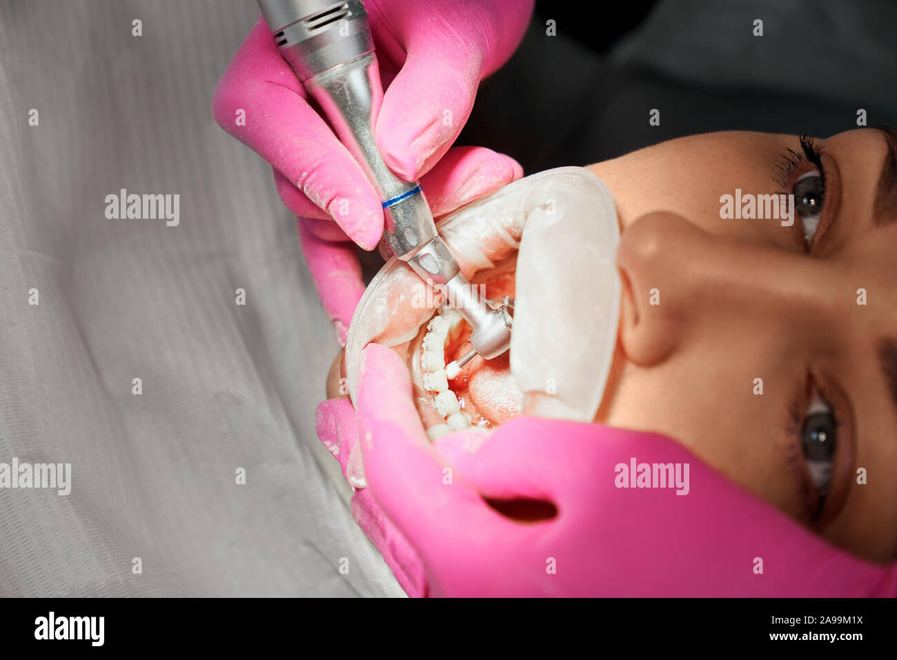Close up de mains de médecin dans les gants en caoutchouc holding spetial instrument dentaire. Nettoyage des dents dentiste patient de la plaque. L'équipement moderne pour enlever la plaque et le traitement. Banque D'Images Close up de mains de médecin dans les gants en caoutchouc holding spetial instrument dentaire. Nettoyage des dents dentiste patient de la plaque. L'équipement moderne pour enlever la plaque et le traitement. Banque D'Images