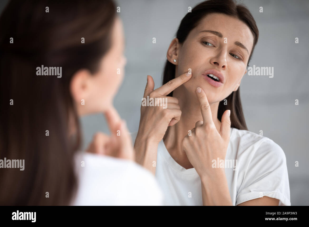 Frustrated woman looking in mirror a souligné à propos de problème de la peau du visage Banque D'Images