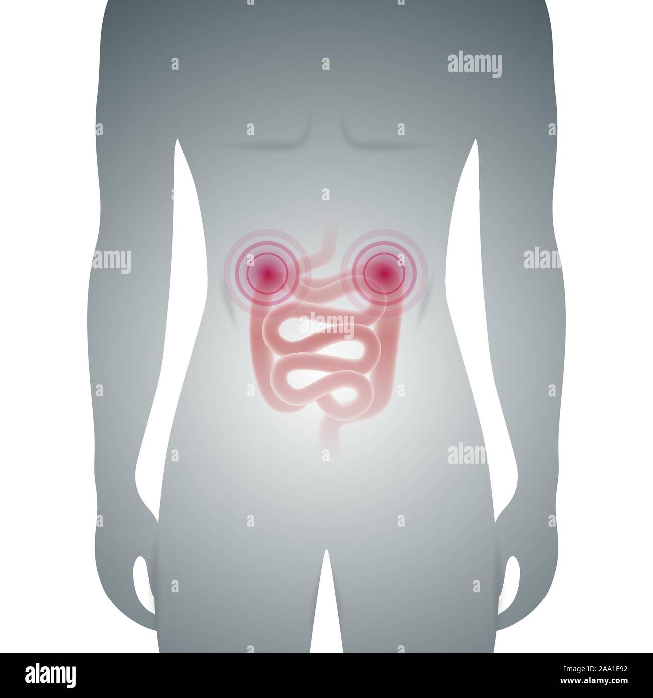 Abstract vector illustration médicale de silhouette masculine avec l'inflammation de l'intestin Illustration de Vecteur