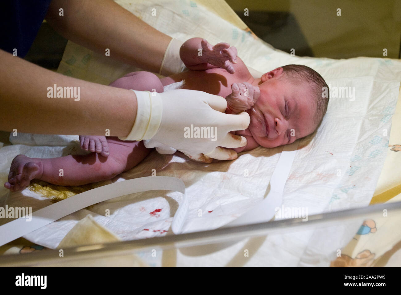 Moments de fille de bébé après une césarienne. ©Marcin Rozpedowski/Alamy Stock Photo Banque D'Images