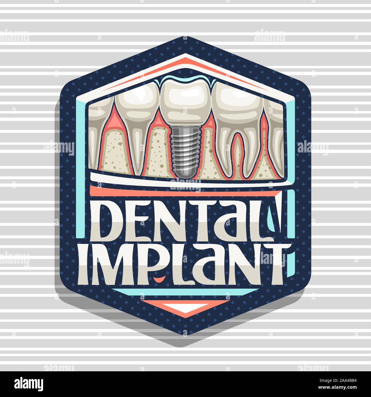 Logo Vector-implants dentaires, sombre avec badge hexagonal caricature dents humaines dans une rangée, lettrage original des mots dental implant, panneau pour pr Illustration de Vecteur