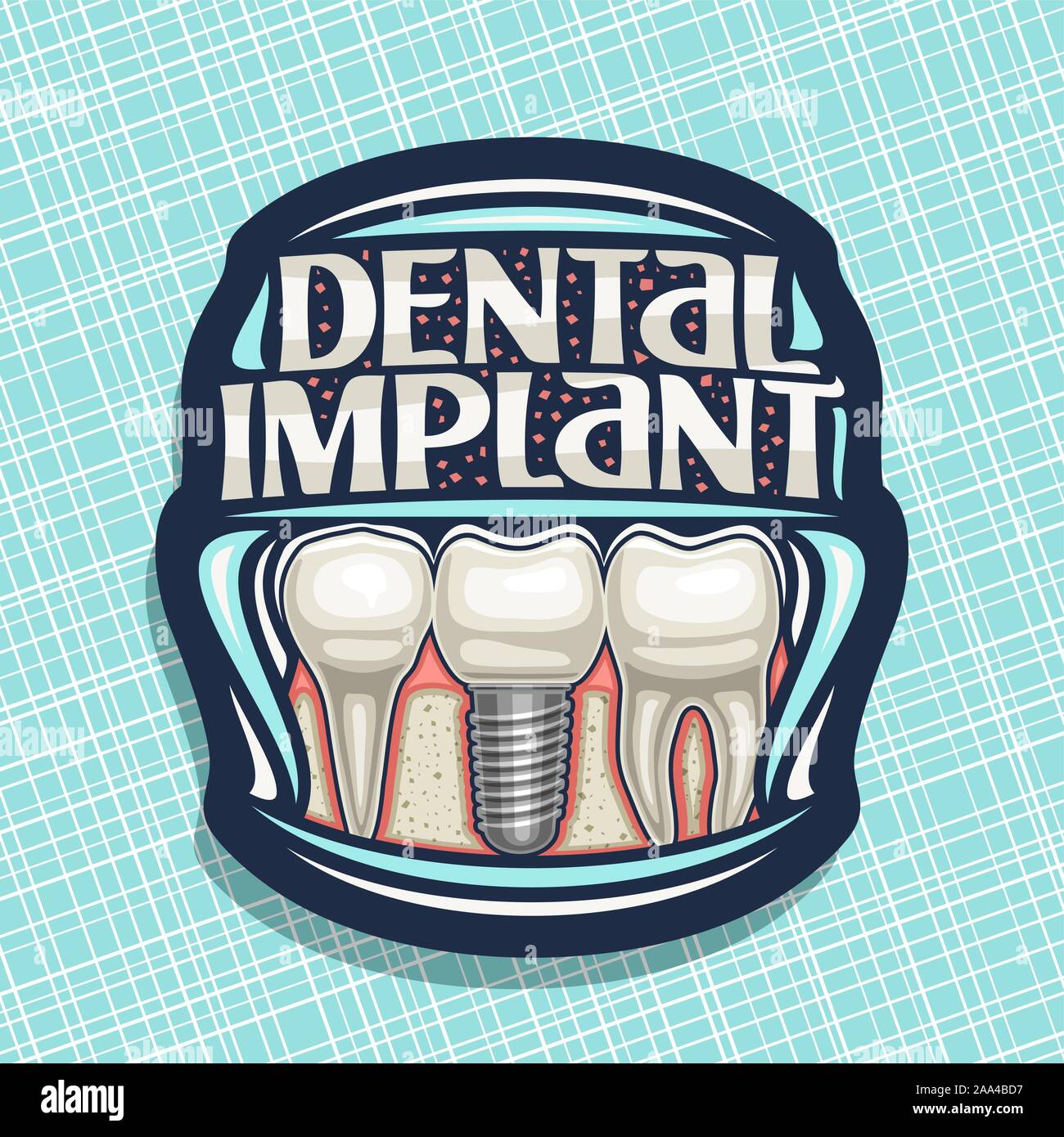 Logo Vector-implants dentaires, sombre décoratif avec étiquette 3 cartoon dents humaines dans la mâchoire, lettrage original des mots dental implant, panneau pour p Illustration de Vecteur