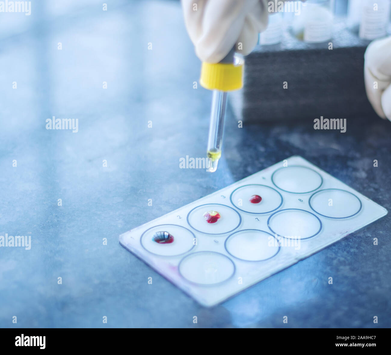 Close up, les mains de sang test groupe appelé protocole du groupage sanguin ABO ou d'essai, l'ajout des antisérums à le sang diminue sur lame de verre Banque D'Images