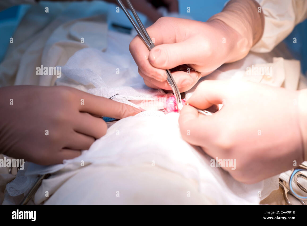 Mains d'un chirurgien pédiatrique close-up, en utilisant l'outil pour séparer les éléments de l'cordon spermatique. Salle d'opération stérile, urologie pédiatrique Banque D'Images