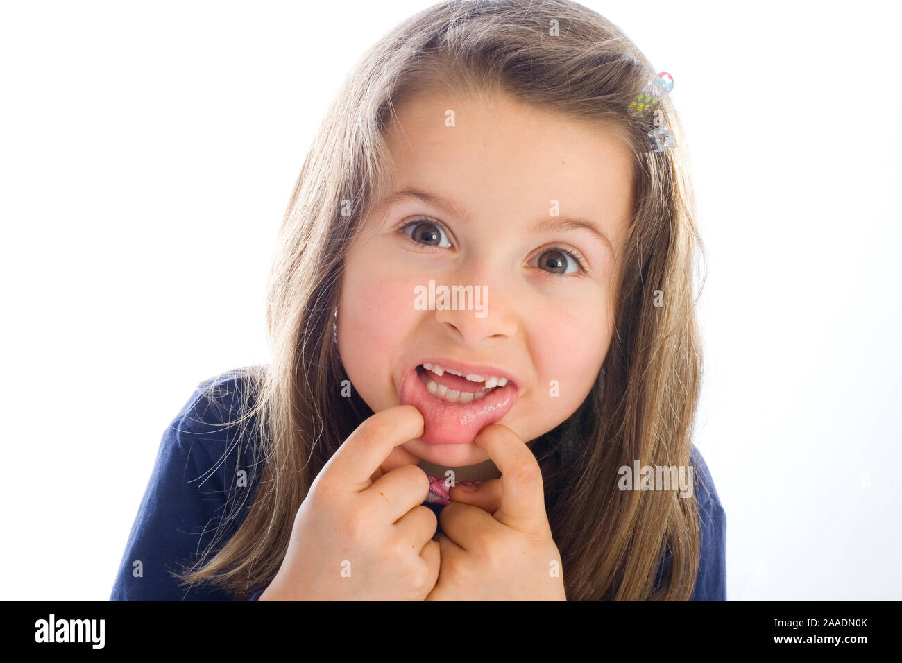 Sechsjähriges Mädchen mit ersten Zähnen (Mr) Banque D'Images