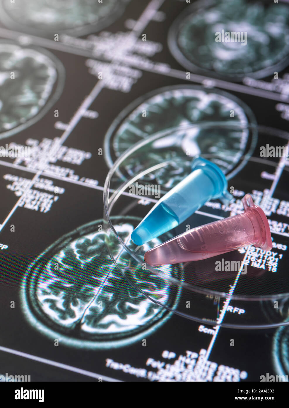 Des échantillons cliniques de projet de recherche figurant dans des flacons avec la numérisation d'images du cerveau, la recherche sur l'Alzheimer et démence de conditions médicales. Banque D'Images