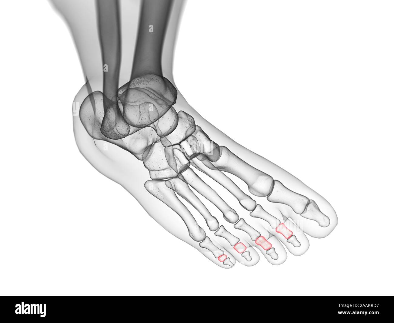 Phalange moyenne os, illustration de l'ordinateur. Banque D'Images