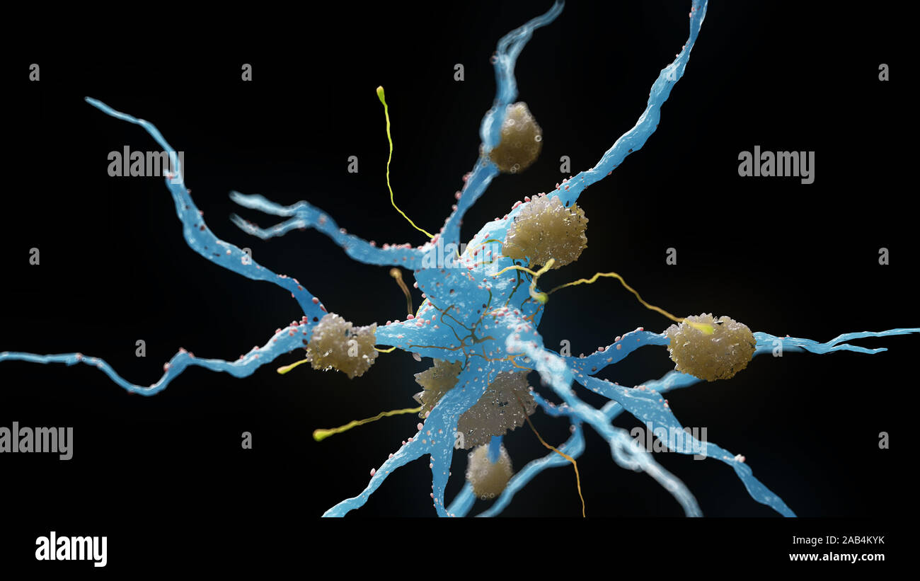 Rendu 3d illustration médicale des cellules nerveuses atteintes de la maladie d'alzheimer Banque D'Images