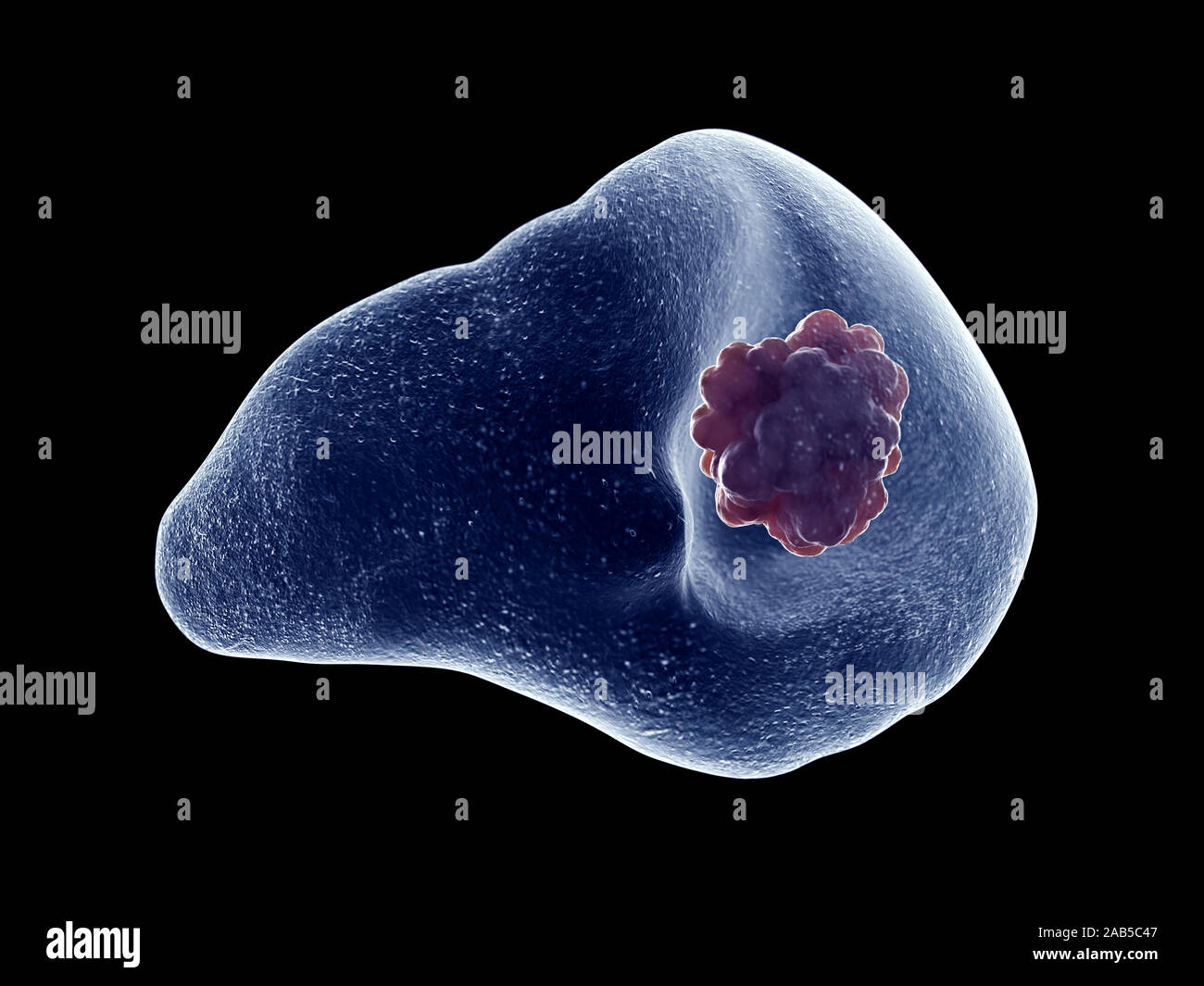 Rendu 3D précis médicalement illustration d'une tumeur de la rate Banque D'Images