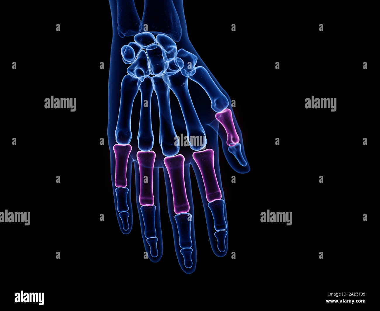 Rendu 3D précis médicalement illustration de la phalange proximale Banque D'Images