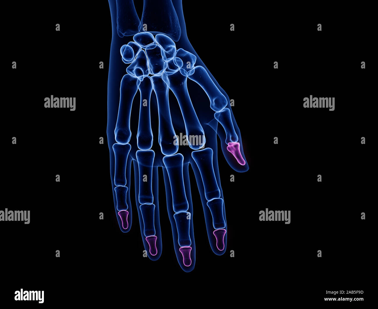 Médicalement en rendu 3d illustration précise des phalanges distales Banque D'Images