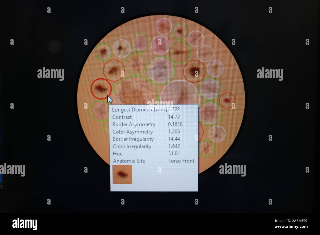 Présentation de la première 3D full-body scanner dans le département de la main, chirurgie plastique et esthétique de l'Hôpital universitaire de Munich en Pettenkoferstraße. [Traduction automatique] Banque D'Images